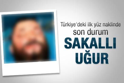 Sakallı Uğur: İlk yüz naklinde son durum