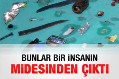 Şizofreni hastası doktorları şaşkına uğrattı 