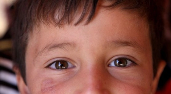 Çatışmaların ortasında kalan masum yüzler